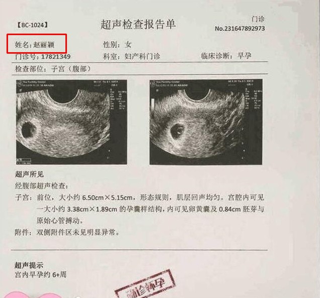 Bác sĩ khẳng định thai chết lưu sang viện khác khám thai vẫn bình thường